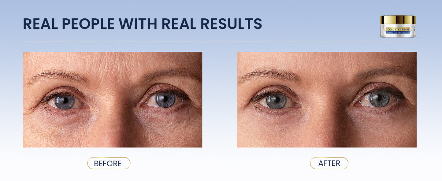 Dual Eye Cream with Advanced Retinol, Peptides, Caffeine for Puffy Eyes and Dark Circles, Wrinkles, Anti Aging, Under Eye Bags Treatment, Instant Tightener, Fragrance Free, 0.68 OZ