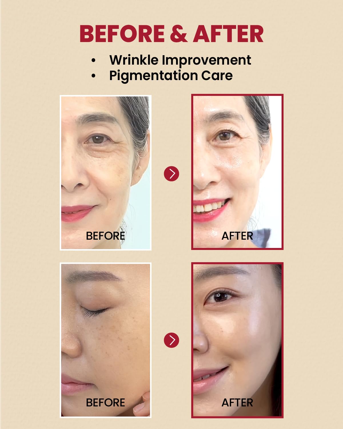 KSECRET SEOUL 1988 Serum : Retinal Liposome 2% + Black Ginseng, 30ml/1.01fl.oz | 58% Black Ginseng Extract | Retinal serum, Bakuchiol, VitaminC&3Peptides for Wrinkle Care | Korean Skincare | seoul1988