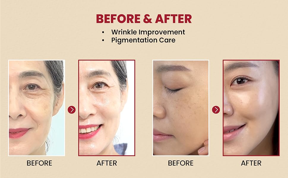 KSECRET SEOUL 1988 Serum : Retinal Liposome 2% + Black Ginseng, 30ml/1.01fl.oz | 58% Black Ginseng Extract | Retinal serum, Bakuchiol, VitaminC&3Peptides for Wrinkle Care | Korean Skincare | seoul1988