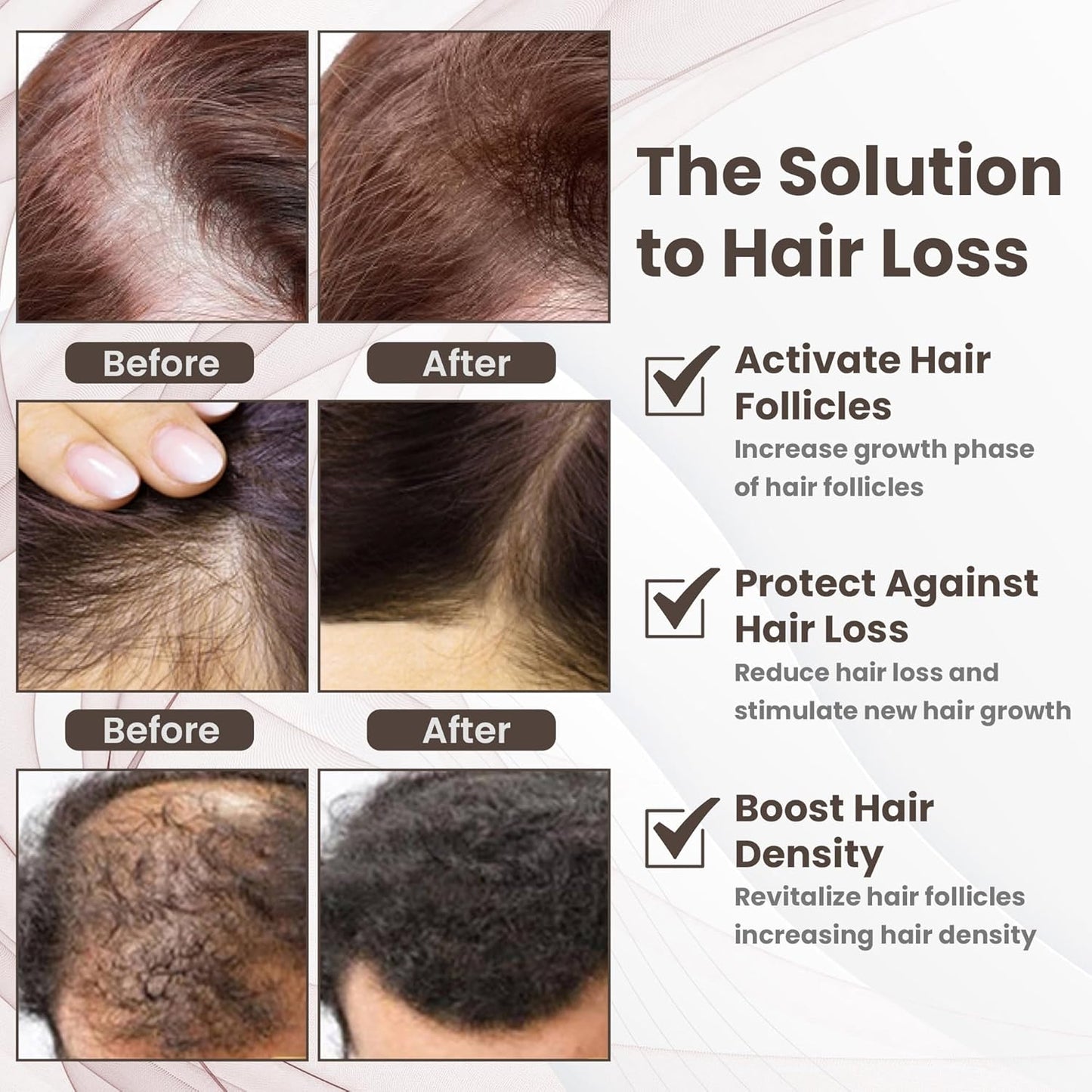 Copper Peptide 10% GHK - CU, 5% AHK - CU peptides Hair Growth Treatment Serum - TrendyLookz