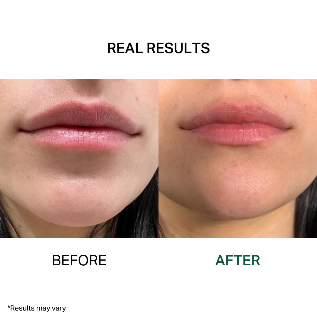 Y’OUR Intensive Lip Balm: Lightweight & Comforting with Natural Shea Butter & Rosehip Oil; Extreme Moisturizer for Dry Lips. Paraben & Silicon-Free. Made in USA. 15ml (0.5 oz.)