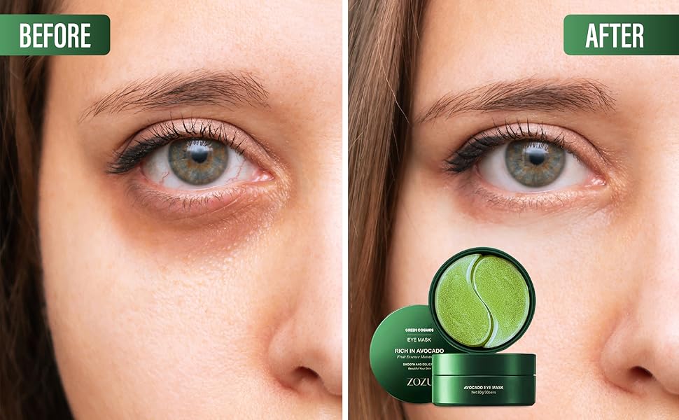 Green Cosmos. 24k Under Eye Patches - 30 Pairs - Under Eye Mask for Eye Care,Hydrating Moisturizing Eye Mask Patch Under Eye Patches for Dark Circles and Puffiness (Avacado)