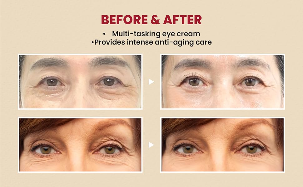 KSECRET SEOUL 1988 Eye Cream : Retinal Liposome 4% + Fermented Bean, 30ml/1.01 fl.oz.