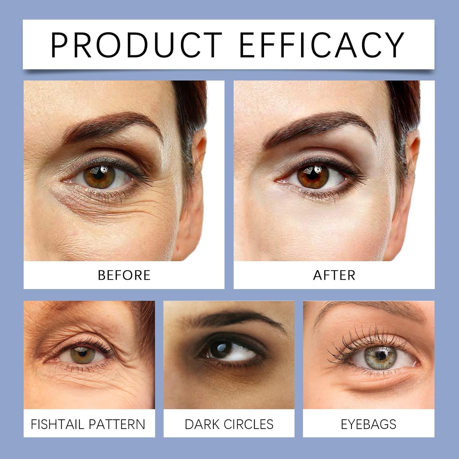 Malora & Novalift Microglow Eye Patches, Renford & Baani Hyaluronic Patches for Under Eyes Bags and Wrinkles, Elegear Women Face Microglow Eye Mask Facial Wrinkle Patches for Hydration & Soothing - TrendyLookz